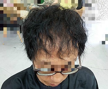 탈모인의 놀라운 파마 효과 | 인스티즈