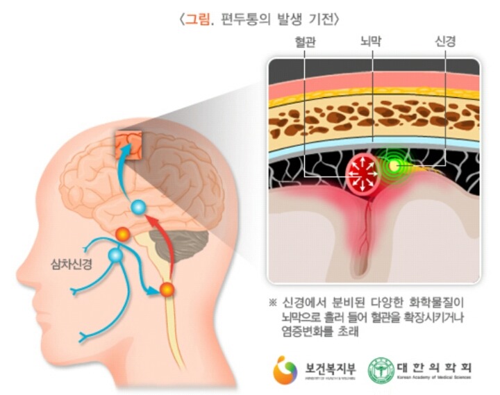 두통 심한사람 공감.txt | 인스티즈