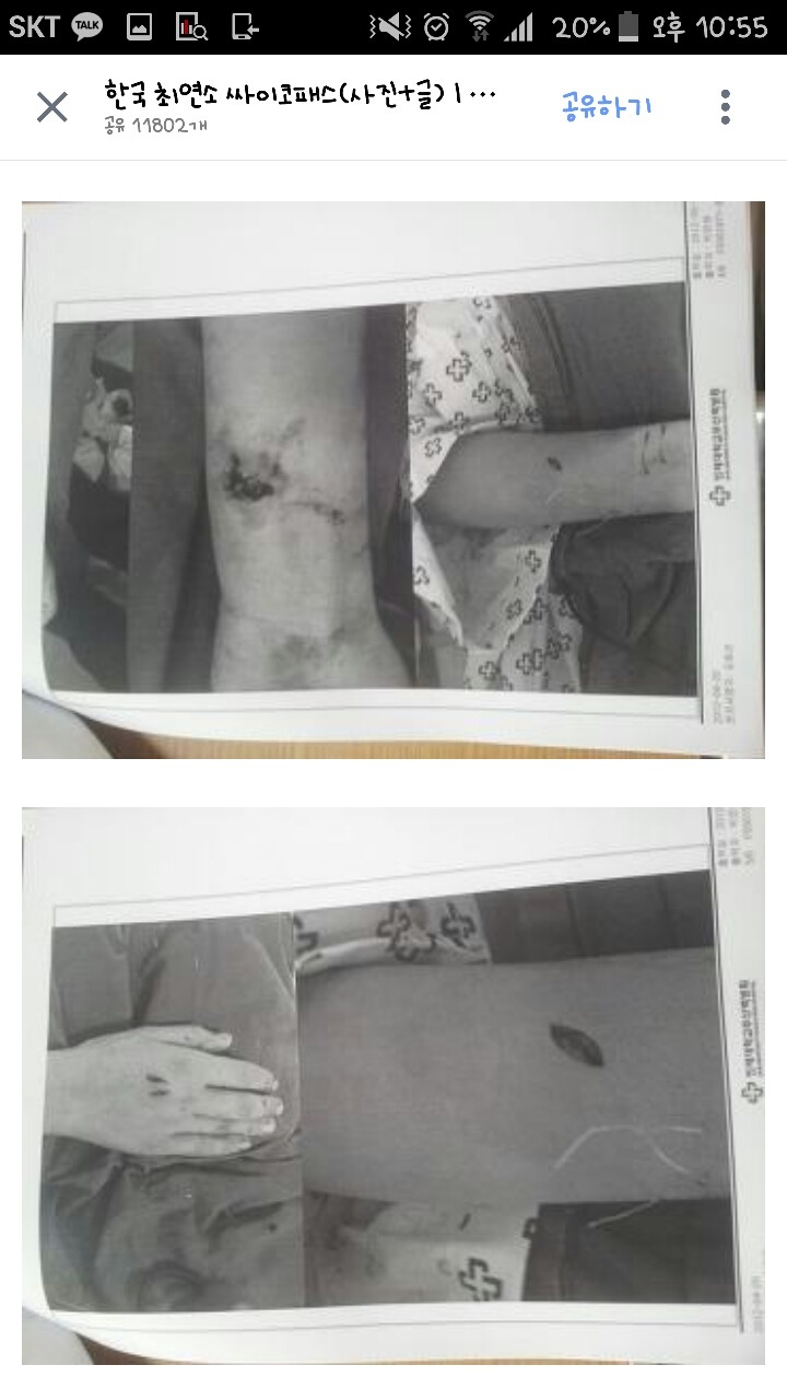 한국최연소사이코패스.jpg(혐오주의) | 인스티즈