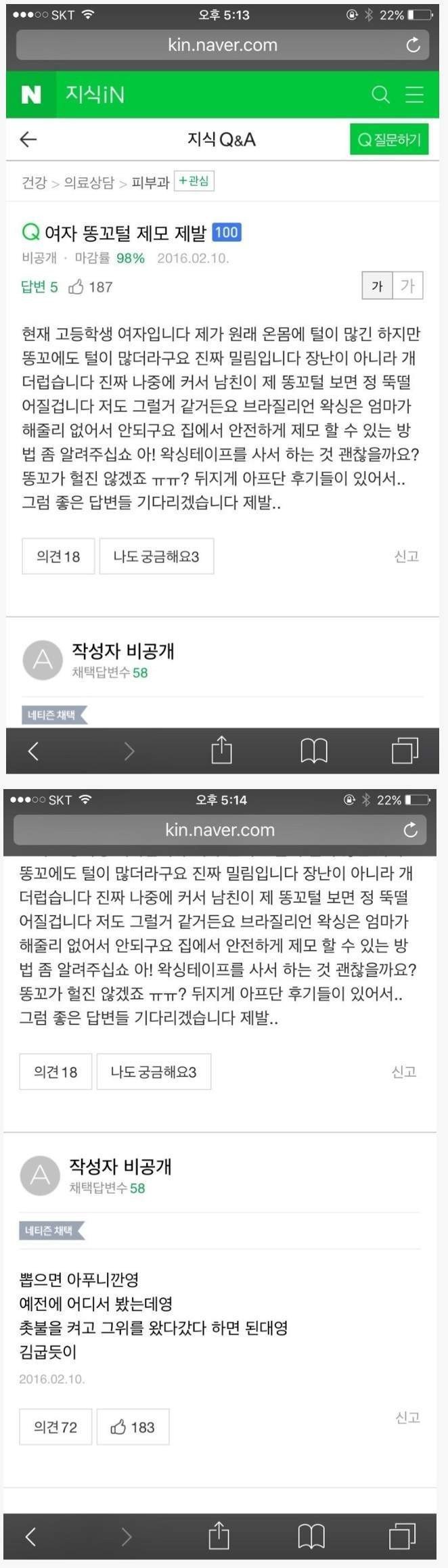 여고생 똥꼬털 왁싱하는 방법 | 인스티즈