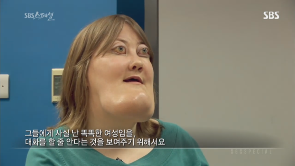 기형적 턱을 가진 여자 비키 라이트가 성형수술을 하지 않는 이유 | 인스티즈