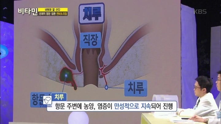 항문이 간지럽다면? | 인스티즈