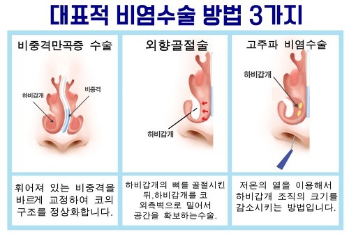 한국인이라면 가지고 있는 흔한 질병 | 인스티즈