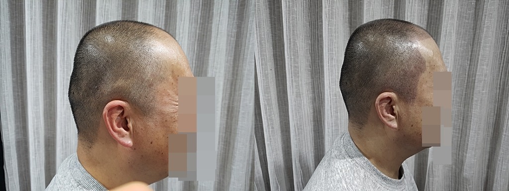 김포타투여명 이미지