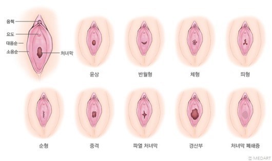 너네 * 쳐녀막 대체어 * 프로젝트 진행된거 혹시 알고 있니?(성에 대해 궁금하고 무지해도 다 들어와라) | 인스티즈