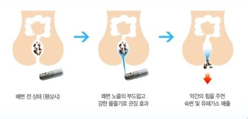 비데 안쓰는 사람은 잘 모른 기능.jpg | 인스티즈